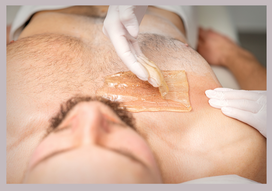 hair removal for men