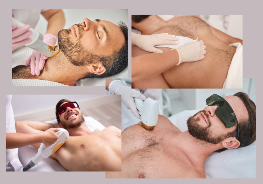 hair removal for men